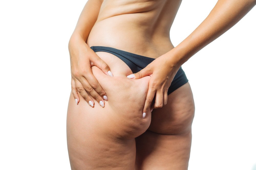 cellulite coppettazione shiatsu